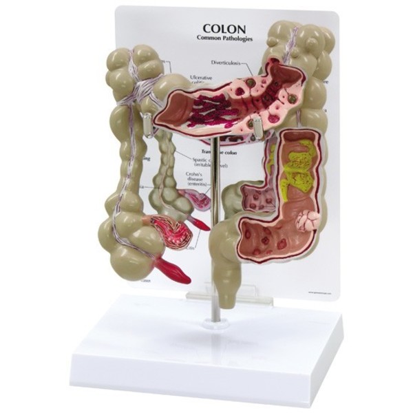 Gpi Anatomical Anatomical Model - Colon 3340